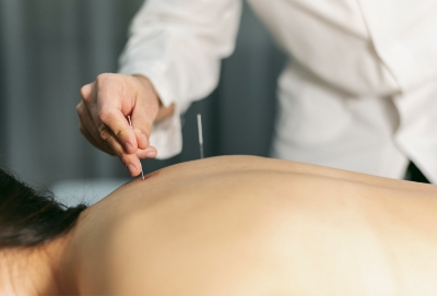 침 치료중인 의사와 환자